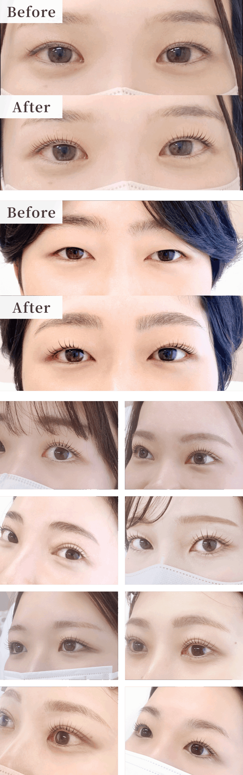 before/after
